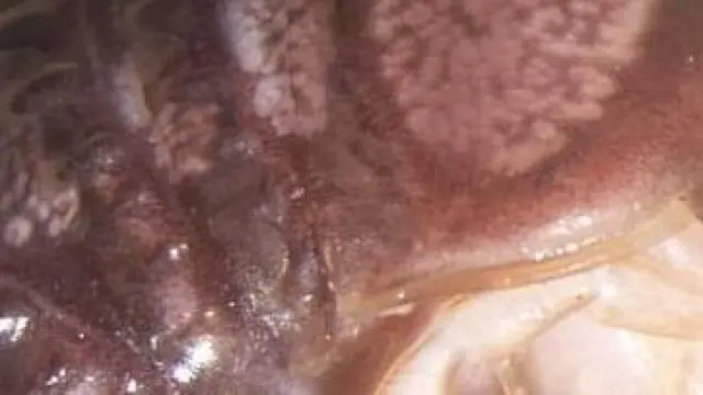Imagen del milpiés con los nuevos hongos señalados con un círculo.