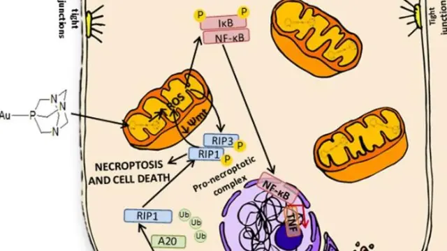 Posible mecanismo de acción de un fármaco de oro sobre una célula cancerígena.