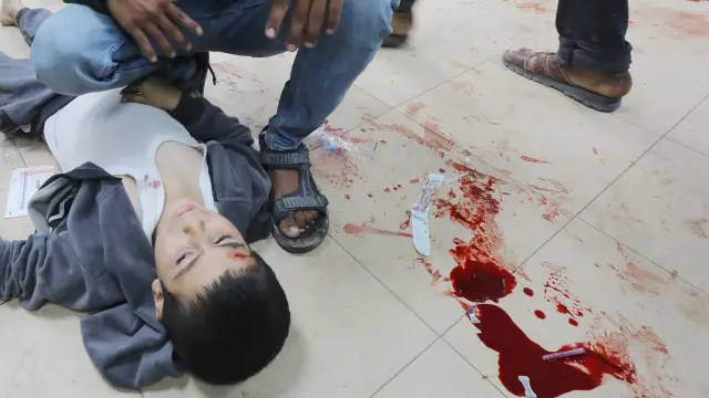 Un niño palestino herido tras un ataque de Israel, este domingo en Gaza.