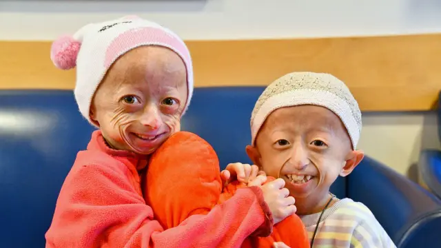 Dos niñas de 9 y 11 años. La progeria es un trastorno genético extremadamente raro y no suele ser hereditario.