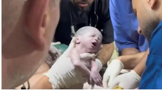 Combo de imágenes del bebé rescatado tras morir su madre y del pequelo en el hospital