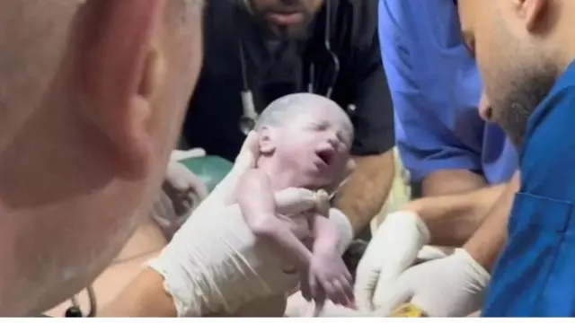 Combo de imágenes del bebé rescatado tras morir su madre y del pequelo en el hospital