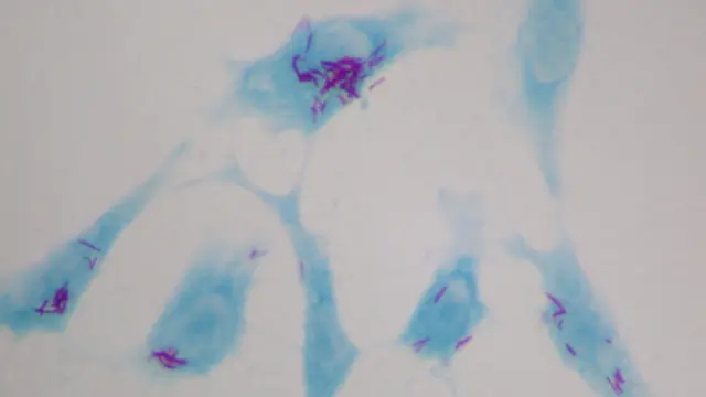 El bacilo de la tuberculosis crece dentro de células humanas