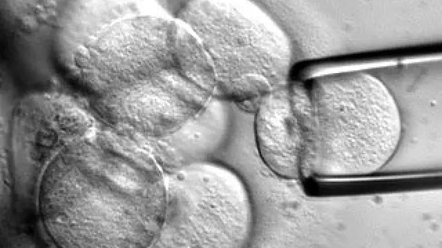 Celulas madre vistas al microscopio