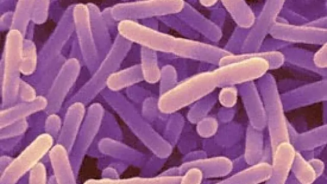 Ejemplo de bifidobacterias; son mayoritarias en los niños y suponen la base de muchos productos probióticos