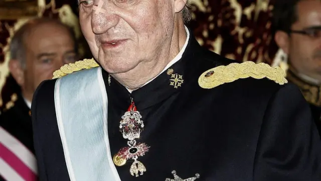 El Rey Juan Carlos con un hematoma en el ojo