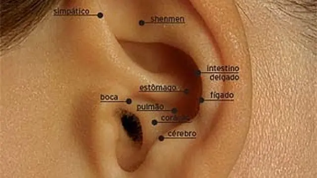 La auriculoterapia es una técnica terapéutica en la que se trata la superficie externa de la oreja o aurícula.