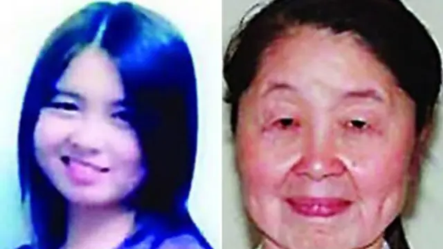 Hu Juan, de 28 años, antes y después de comenzar a sufrir su enfermedad