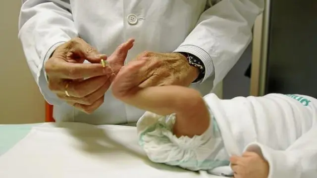 Aragón realiza desde 1979 la prueba del talón para evitar el hipotiroidismo neonatal