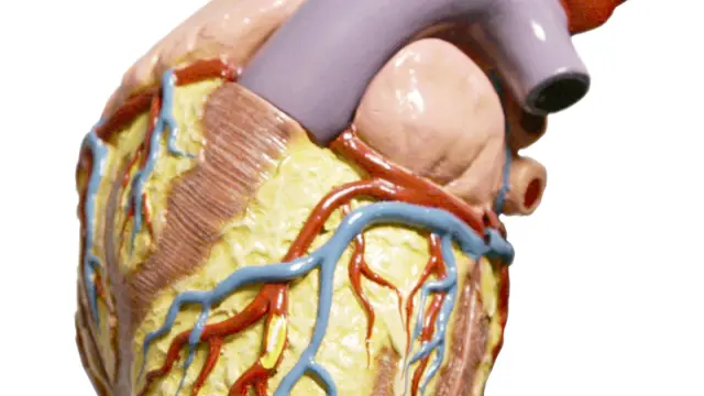 Las dolencias cardiacas son las principales causantes de muertes por enfermedad no transmisible.