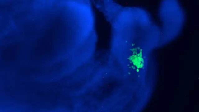 Células pluripotentes humanas en un embrión de ratón.