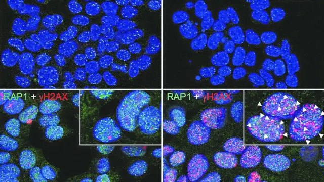 Las células de cáncer de pulmón tratadas con el inhibidor de TRF1 del CNIO muestran menos TRF1 unido a sus telómeros y un mayor daño del ADN telomérico y, por tanto, una mayor desprotección de los telómeros que las células cancerosas sin tratar.