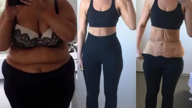 Imagen que prueba cómo Simone Anderson fue capaz de adelgazar 80 kilos