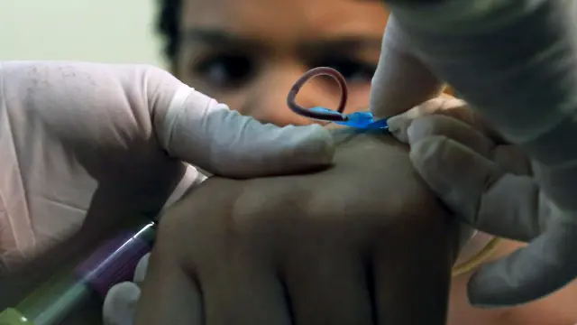 Un médico toma una muestra de sangre a un niño en Brasil para hacerle la prueba del virus zika.