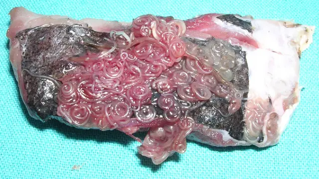 Larvas de anisakis sobre merluza.