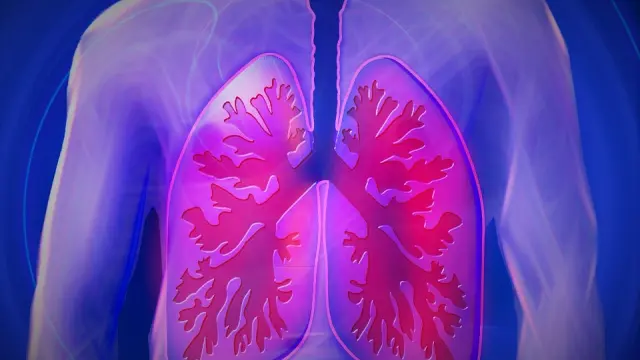 La EPOC afecta a la salud pulmonar.