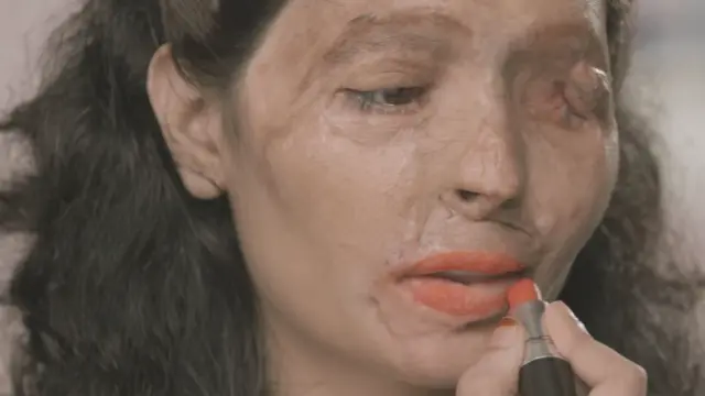 Reshma Qureshi, una gurú del maquillaje tras ser quemada con ácido.