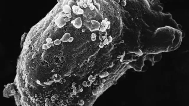 Vista al microscopio electrónico de un linfocito con VIH