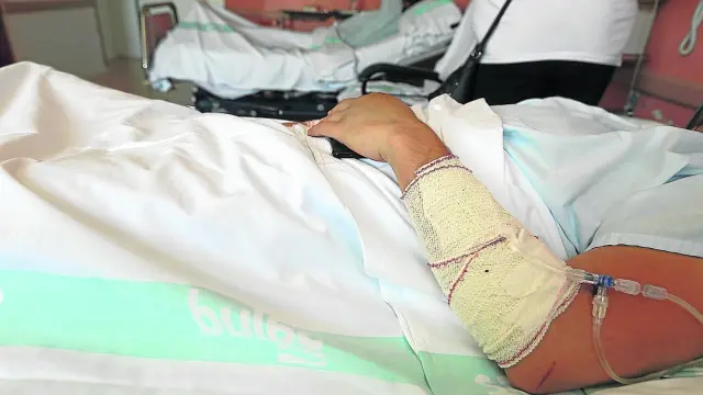 Rodrigo M. tiene fracturas en tres volúmenes y la clavícula, además de heridas en los brazos.