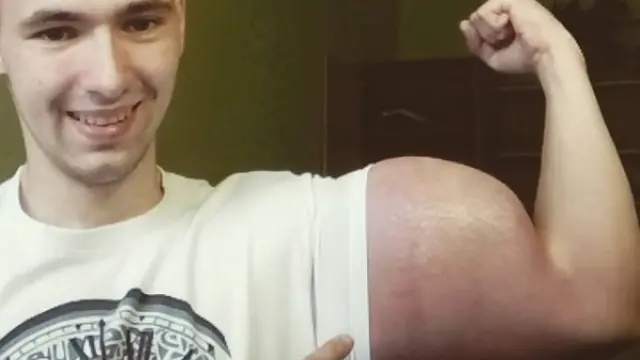 Kirill Tereshin mostrando su bíceps.