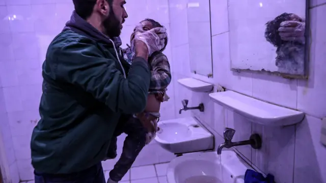 Un niño recibe atención médica tras ser herido en un bombardeo en Duma
