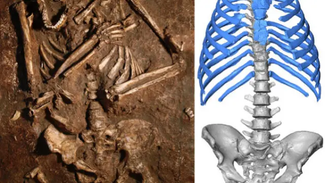 Los neandertales caminaban más erguidos y tenían más capacidad pulmonar que nosotros