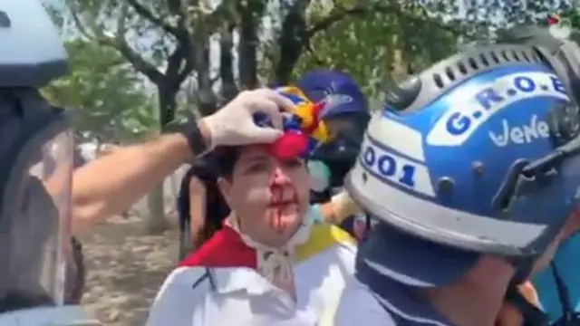 Un hombre herido en los disturbios de Venezuela.