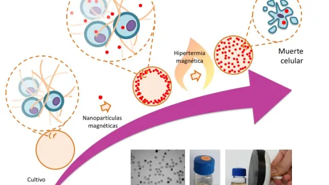 El calor generado por nanopartículas magnéticas (de unos 12 nanómetros de diámetro) puede destruir las células tumorales o hacerlas más sensibles a la quimio y radioterapia.