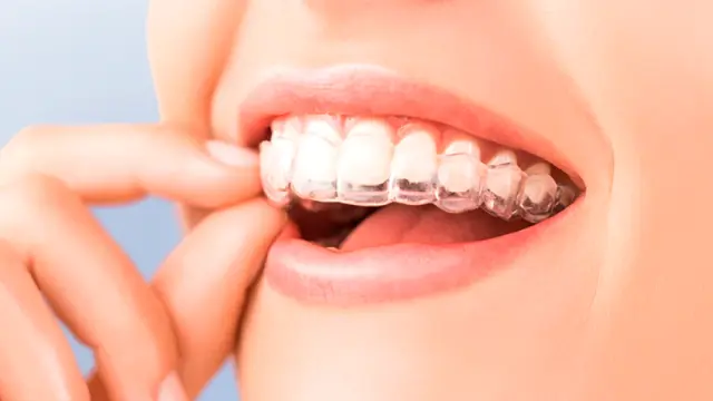 La ortodoncia es mucho más que conseguir una sonrisa estética