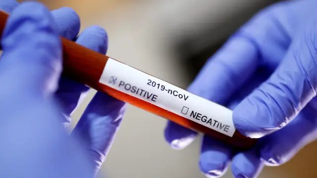 FILE PHOTO: Test tube with Corona virus name label is seen in this illustration taken on January 29, 2020. REUTERS/Dado Ruvic/File Photo [[[REUTERS VOCENTO]]] HEALTH-CORONAVIRUS/TELEHEALTH