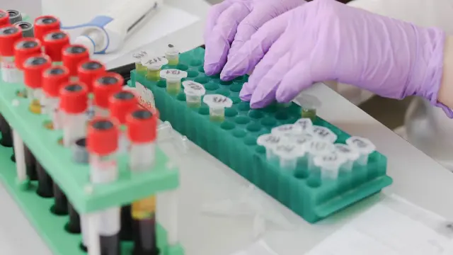 Procesado de muestras biológicas para el análisis por PCR.
