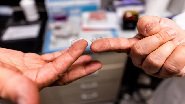 Fingertip-sized patches with dissolvable microscopic needles, a potential COVID-19 vaccine, are seen at the University of Pittsburgh, Pittsburgh, Pennsylvania, U.S., March 28, 2020. UPMC/Handout via REUTERS ATTENTION EDITORS - THIS IMAGE WAS PROVIDED BY A THIRD PARTY. MANDATORY CREDIT. NO RESALES. NO ARCHIVES [[[REUTERS VOCENTO]]] HEALTH-CORONAVIRUS/VACCINE-CANDIDATE