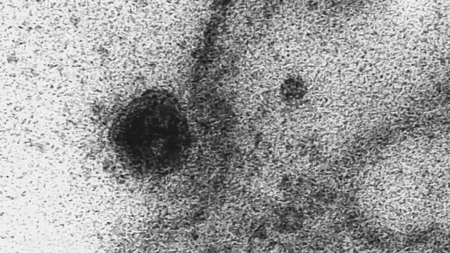 Así infecta el coronavirus a una célula