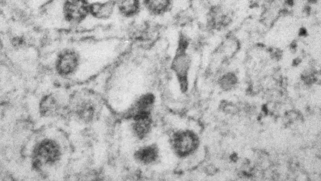 Imagen de los primeros SARS-CoV-2 aislados y fotografiados en Aragón mediante un microscopio electrónico de transmisión.