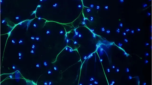 Neutrófilos activados (azul) lanzan redes de cromatina (verde) para atrapar patógenos.