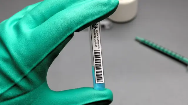 Foto de archivo de una prueba de coronavirus