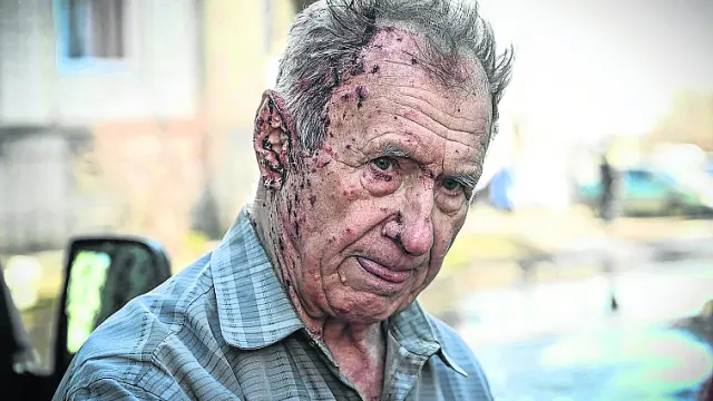 Un hombre herido por los bombardeos en Járkov.