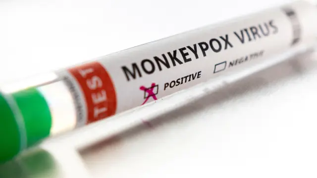 FILE PHOTO: Illustration shows test tube labelled "Monkeypox virus positive\