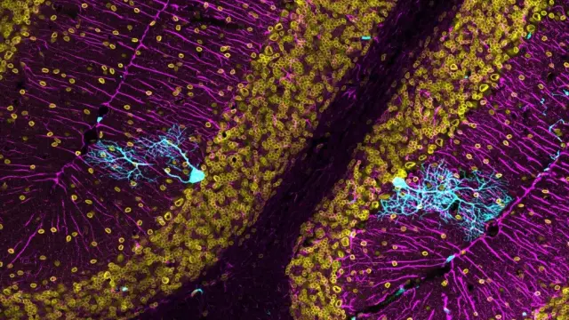 La imagen titulada 'Recordando a Cajal para tratar la neurodegeneración' obtuvo el premio Fotciencia en la modalidad especial Año Cajal