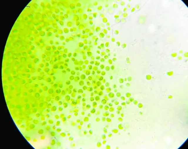 Imágenes al microscopio de las microalgas utilizadas en Biocid.