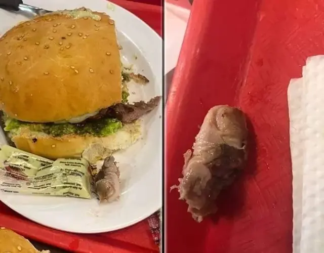 El hallazgo fue compartido por la comensal el domingo a través de las redes sociales en la que compartió unas fotografías de la hamburguesa y el dedo que encontró