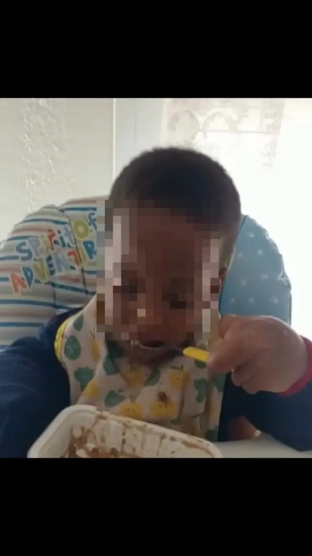 El niño de dos años, tras un mes y medio de la operación, sosteniendo una cuchara.