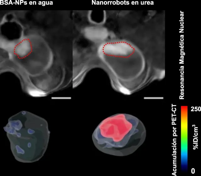 Localización del tumor de vejiga mediante resonancia magnética y acumulación de nanorrobots en el tumor, cuantificada mediante tomografía por emisión de positrones