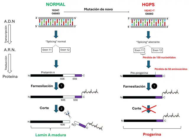 Durante el proceso de formación de la proteína lamin A, el gen correspondiente codificado en el ADN se transcribe en ARN. Tras su maduración, se produce una proteína que experimenta dos modificaciones: la adición de un grupo farnesilo (farnesilación) y un corte específico en la proteína (en la región indicada). En los niños con el síndrome de Hutchinson-Gilford (HGPS), se produce una mutación en la posición 1824 (C->T). Esta mutación provoca la pérdida de 150 nucleótidos codificantes, lo que se traduce en la pérdida de 50 aminoácidos en la proteína final. Como resultado, la proteína resultante (pre-progerina) se farnesila, pero no puede ser cortada correctamente.