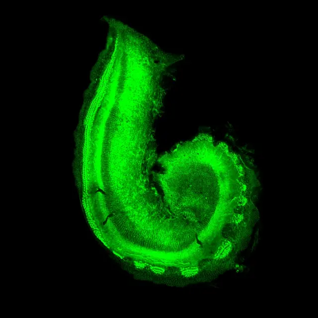 Imagen de la cóclea en desarrollo de un ratón donde se muestran las células ciliadas.
