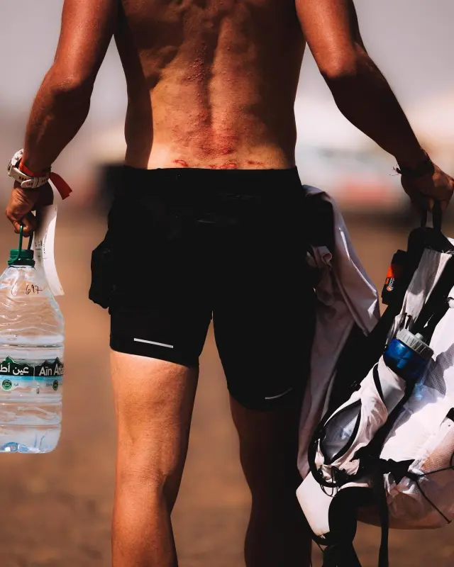 Detalle de la espalda de Juan Carlos Gimeno, con heridas por el peso de la mochila.