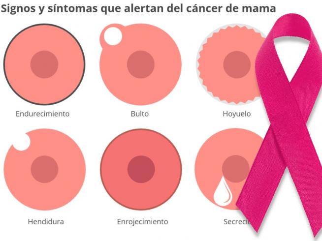 pistón Gruñón Fanático Día contra el cáncer de mama: Los signos externos que pueden delatar un  tumor en el pecho