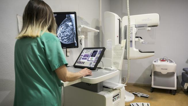 Analizando mamografías