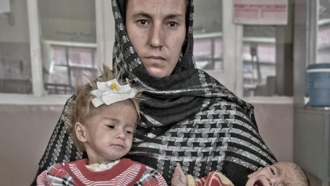 Huma con sus hijas, Sunita (4 meses y 3 k de peso), y Parisa (2 años y 5,8 k), ingresadas en el hospital Indira Gandhi. Viven en Kabul. "Me casé hace nueve años y he tenido ocho criaturas", se lamenta. Tiene cinco hijos más, de 8, 7, 5, 4 y 3 años. "Entre el segundo y el tercero, se me murió uno y acabo de abortar", explica.
