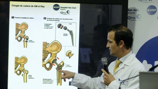 El doctor Villamayor explica los detalles de la operación